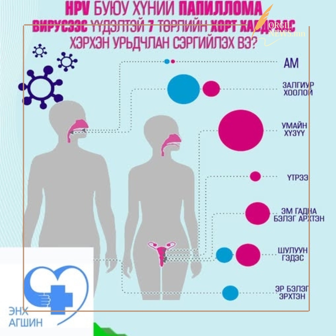Хүний папиллома вирусээс хамгаалах вакциныг 11 настай хүүхдүүдэд товлолын дагуу хийж байна.