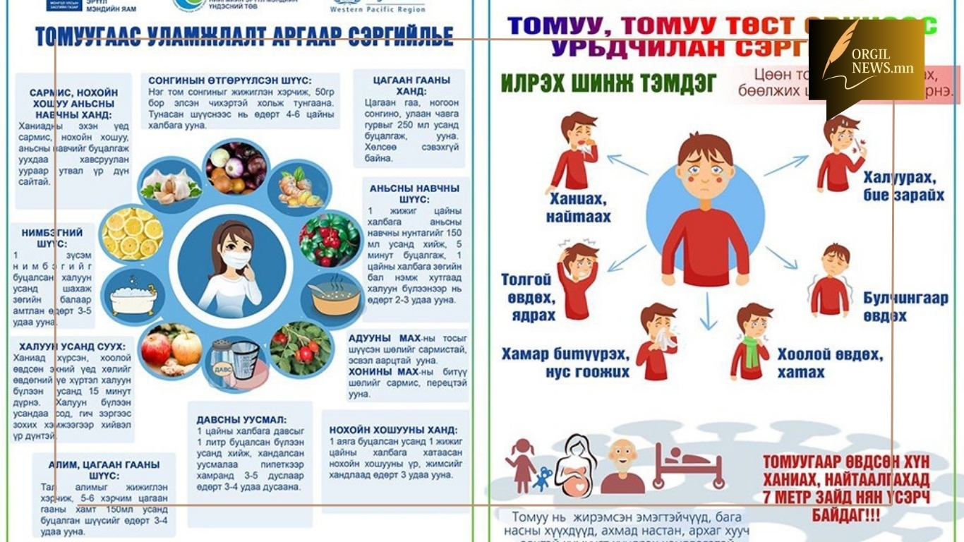 Томуу, томуу төст өвчнөөр оношлогдсон хүний тоо 14,308-д хүрчээ